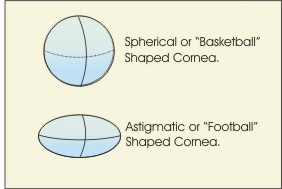 compare spherical vs. astigmatic eye